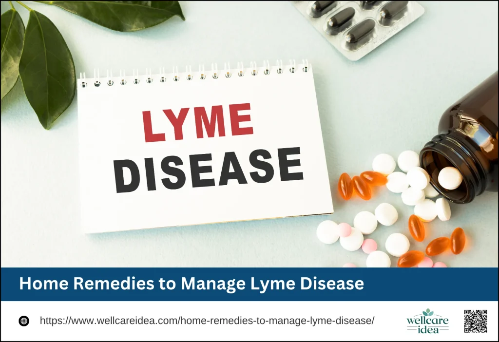 Home Remedies to Manage Lyme Disease